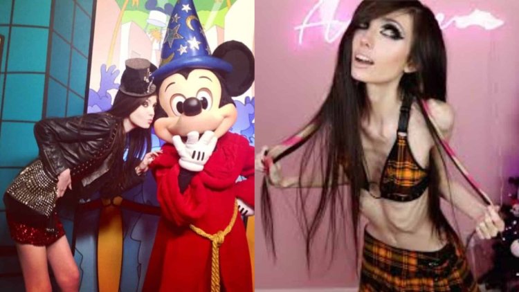 Eugenia Cooney anorexichka