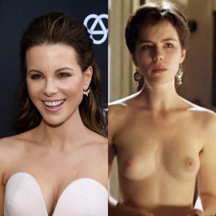 Kate Bekinsale before and after plastic