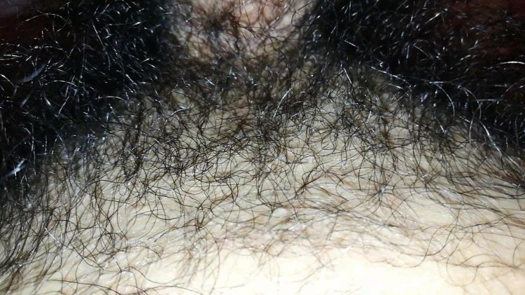 Female pubic hair