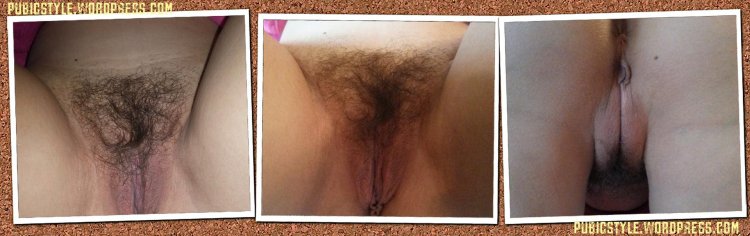 Explification of female pubis