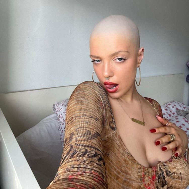 Bald head woman