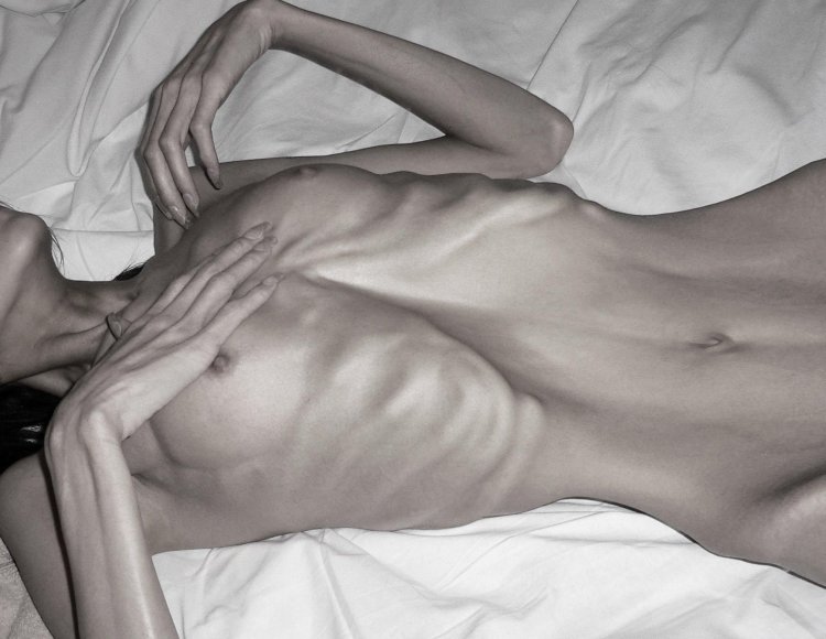 Beautiful naked anorexics