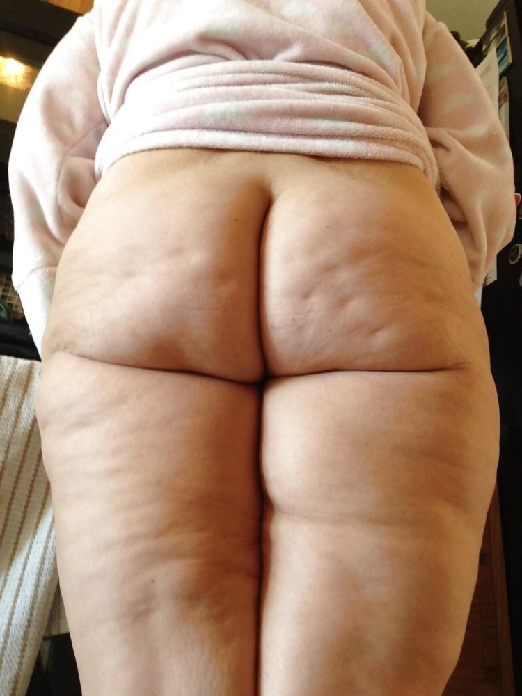 Lipodistrophy cellulite