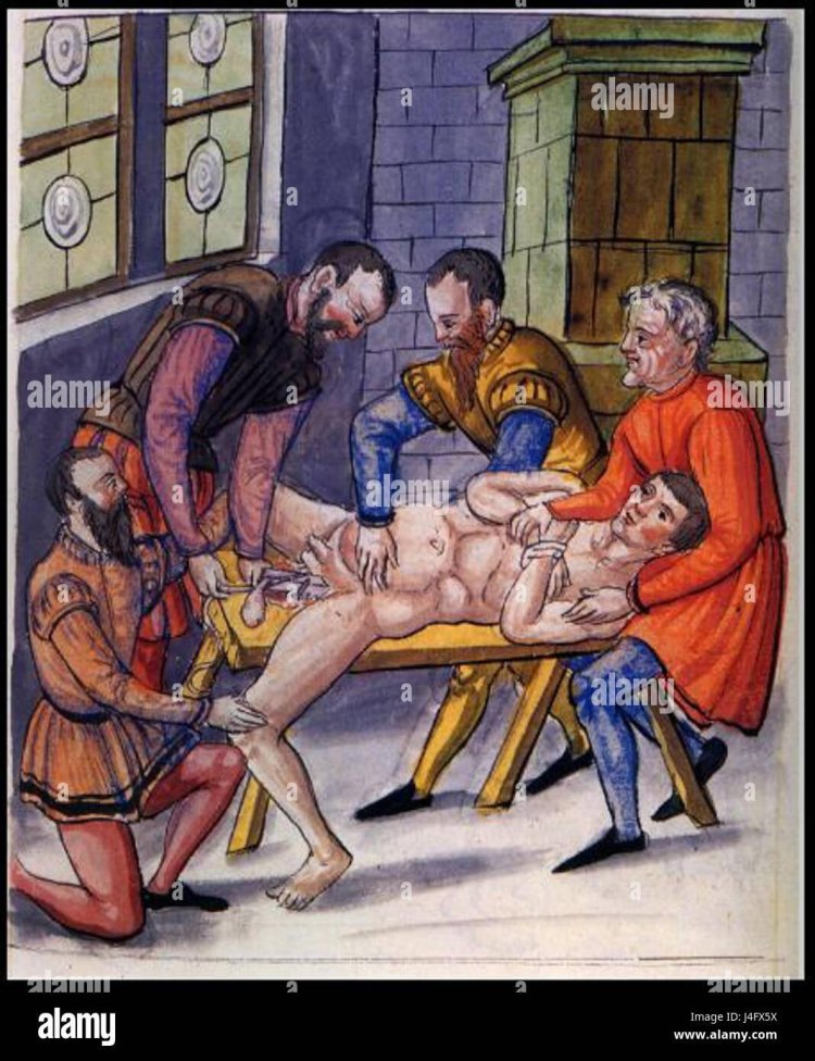 Middle Ages Medicine