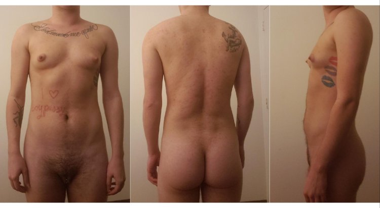 Falloplasty transgender people