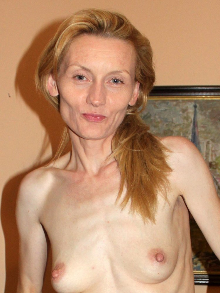 Isabelle Karo anorexia