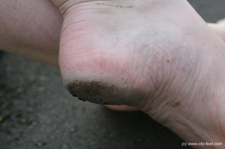Dirty heels