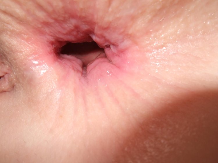 Anus women