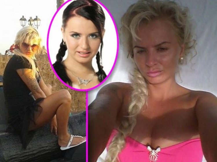 Pynzar Daria before and after operations