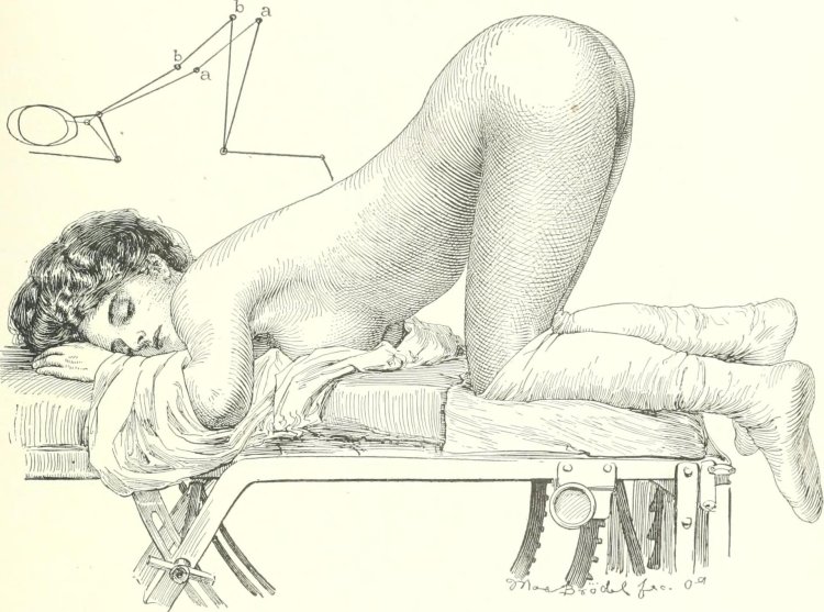 The position of Trendelenburg