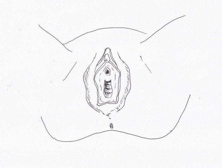 Breaks of perineum and vagina