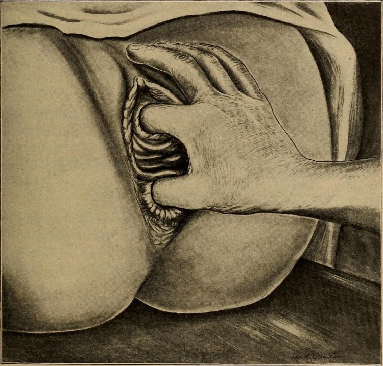 Vulva Art image