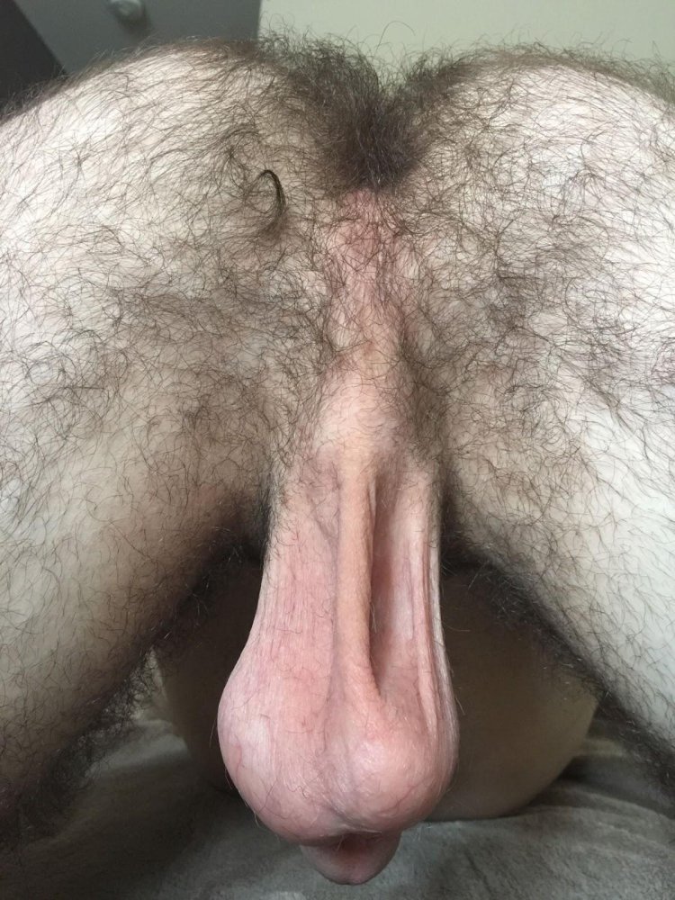 Very hairy scrotum