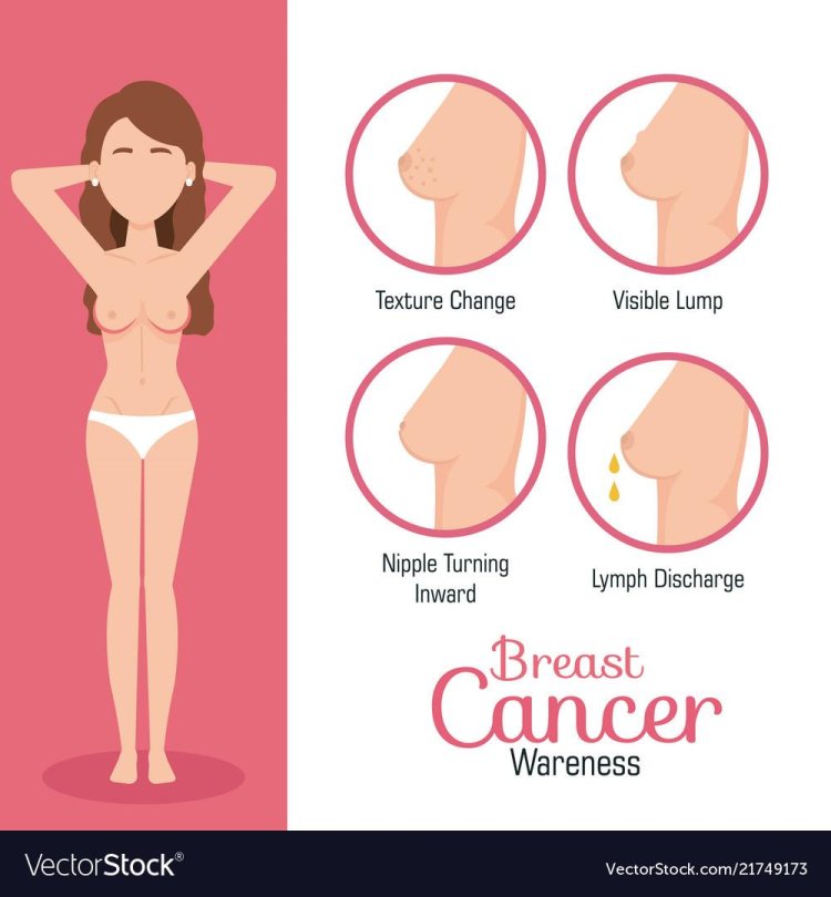 Breast types of women