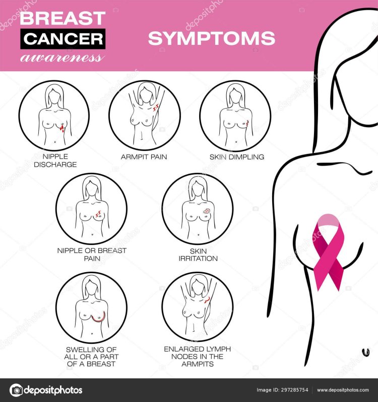 Breast Cancer Symptoms