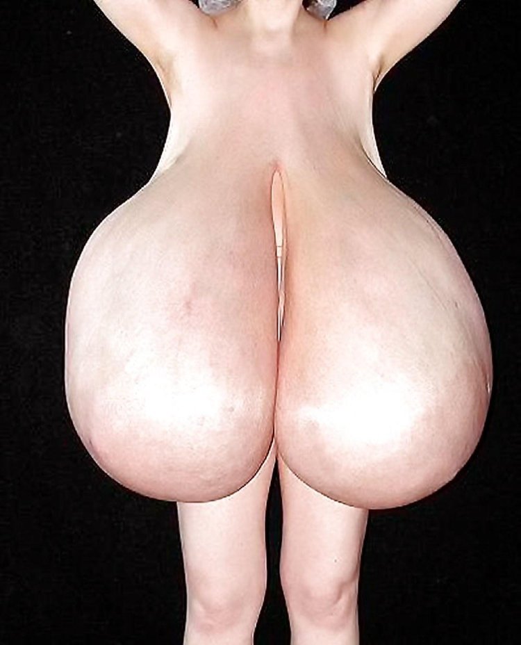 Macomastia gigantomastia