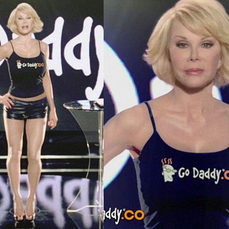 Joan Rivers before and after plastics