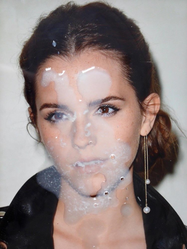 Conducted EMA Watson