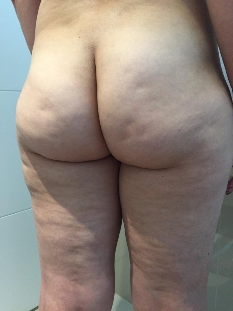 Naked asses with cellulite