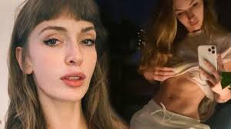 Yasemin Allen Rinoplasty