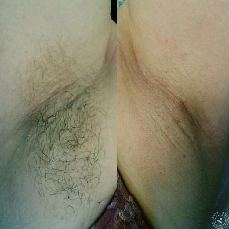 Bikini Big Plan Deep