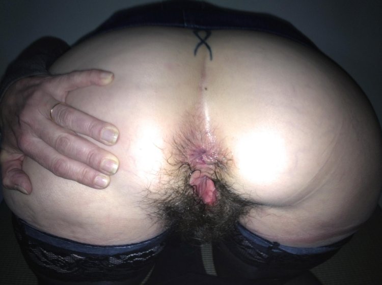 Dirty hairy female anus