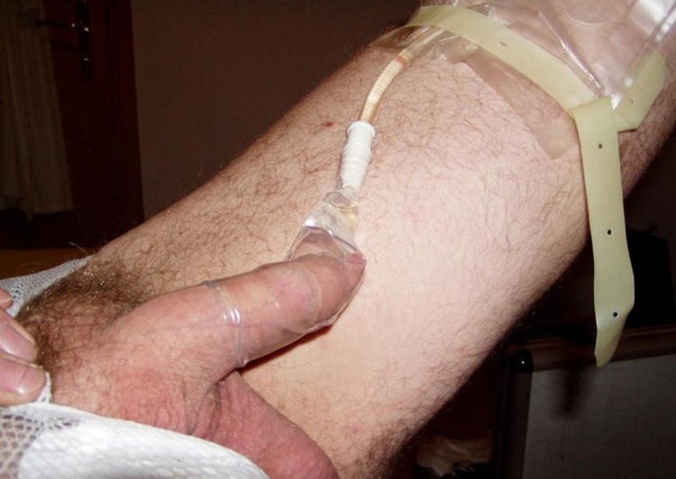 Full catheter ejaculation