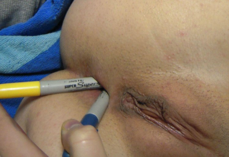 Ballpoint pen in pussy