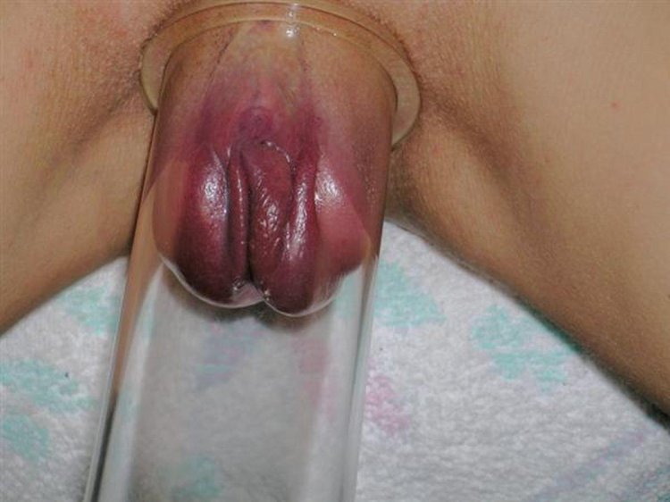 Extreme vagina pumping