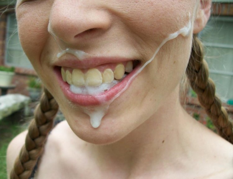 Girls with braces Cumshot