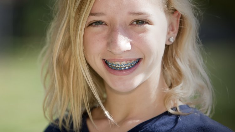 Blonde with braces
