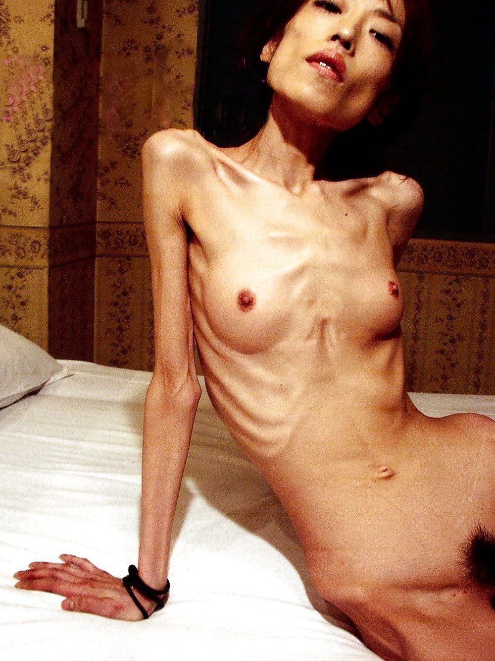 Anorexic Nude - 57 photos
