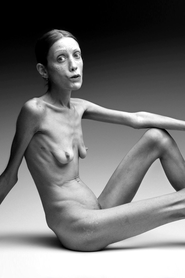 Anorexic Nude.