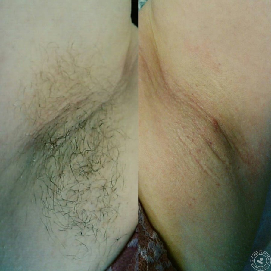 Close-up deep bikini