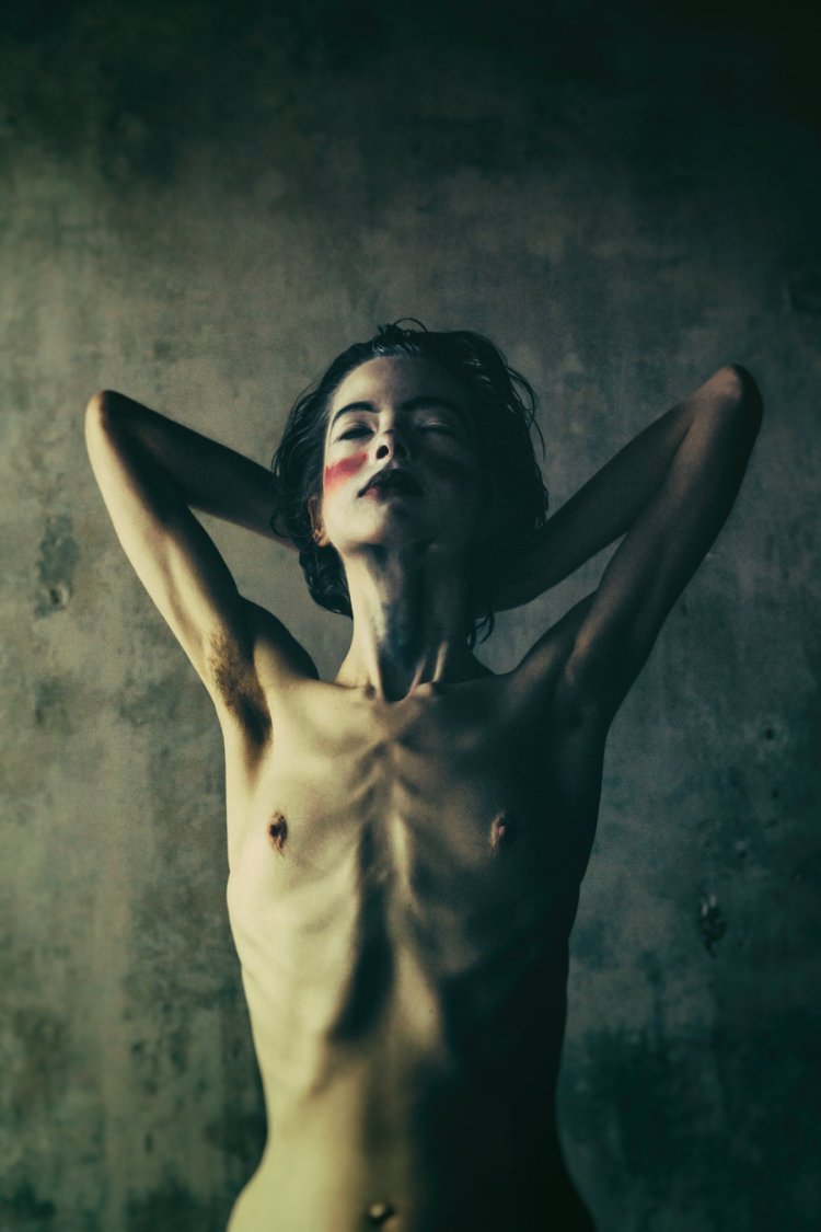 The Naked Truth ABOUT MALI's EATING DISORDER