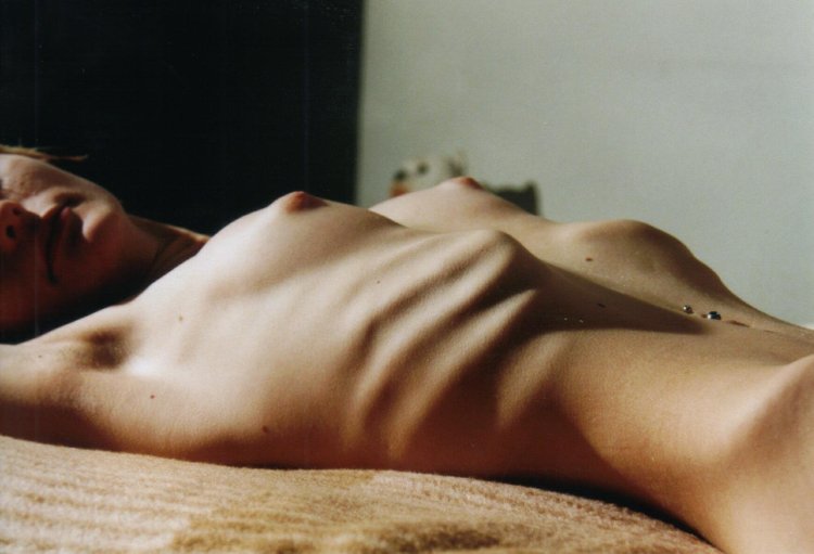 Beautiful naked anorexics