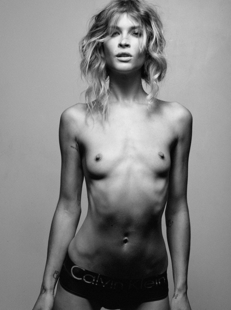 Naked women with anorexia