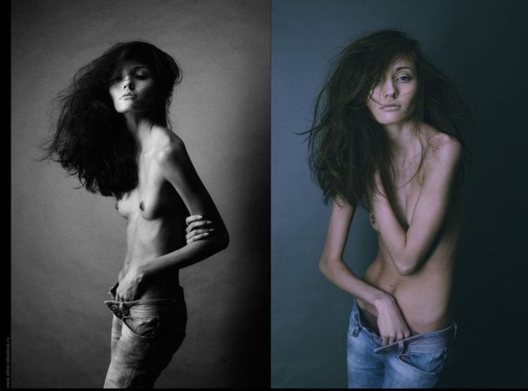 Photographer Dmitry Belyaev Nudinka Anorexic