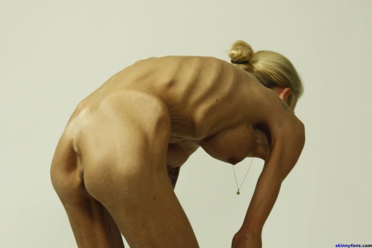 Naked anorexic women